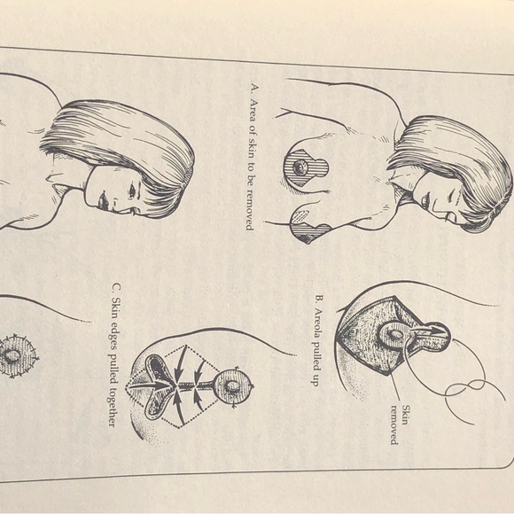 Dr Susan Love's Breast Book 2000 3rd Ed Fully Revised Paperback Breast Cancer - Picture 6 of 12